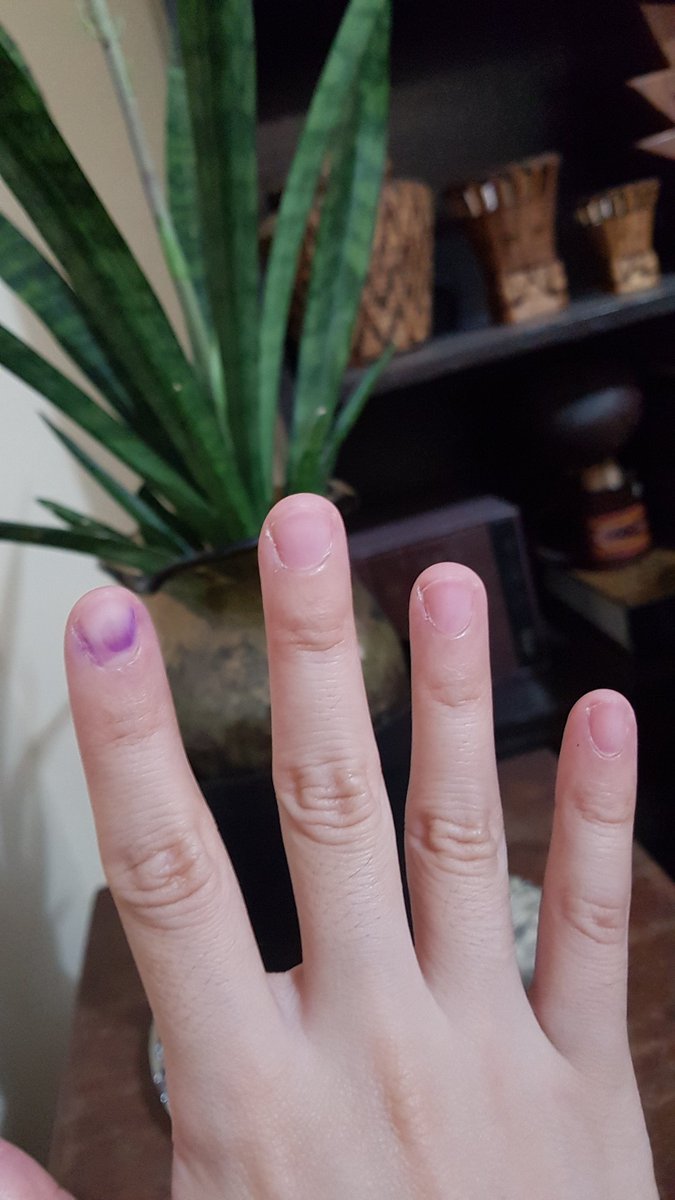 senoradonfuton's tweet photo. Voted pink, now inked 💕 #VotePH https://t.co/uuOSGfx8mV