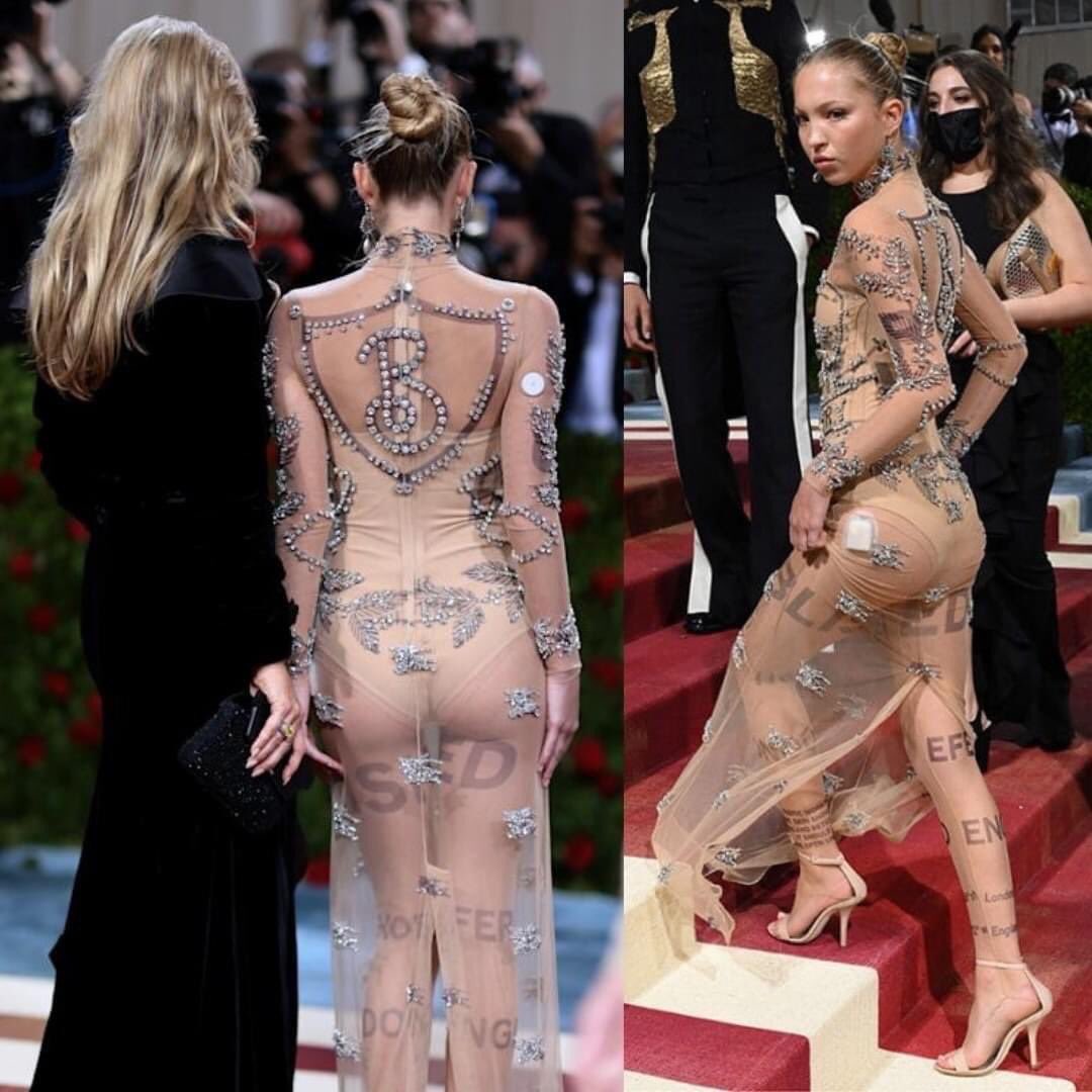 MedBunker's tweet photo. Cosa sono quei “cerotti” mostrati dalla modella Lila Moss? Un sensore e un microinfusore. La donna, affetta da diabete e che si è sempre battuta per sensibilizzare sul tema, monitora continuamente i livelli di glicemia, poi regolati dall’insulina somministrata automaticamente. https://t.co/kNLs2PbHCf