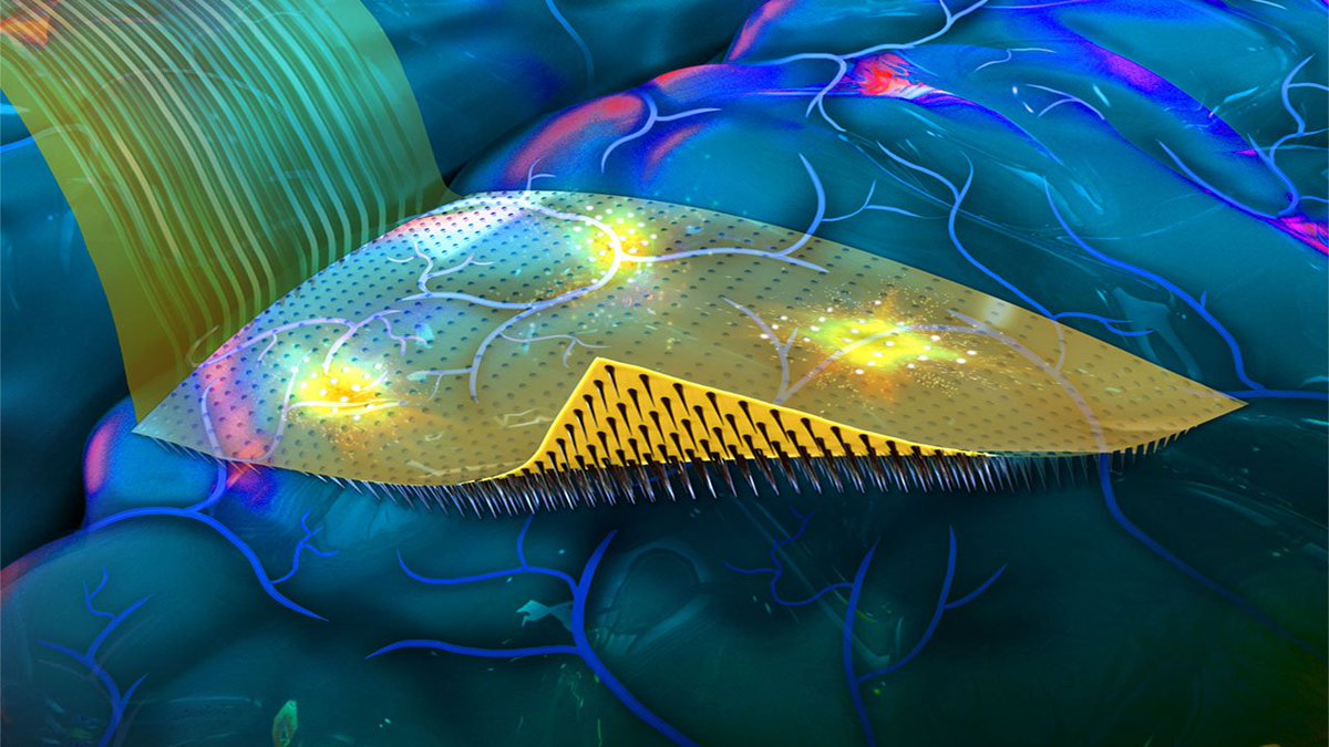 NeurosciTek's tweet photo. A New #Brain_Machine Interface with a Flexible Backing;
The flexible backing allows arrays of micro-scale needles to conform to the contours of the brain, which improves high-resolution brain recording.
https://t.co/Lu3d3stQ2f https://t.co/HsjUkv7roU