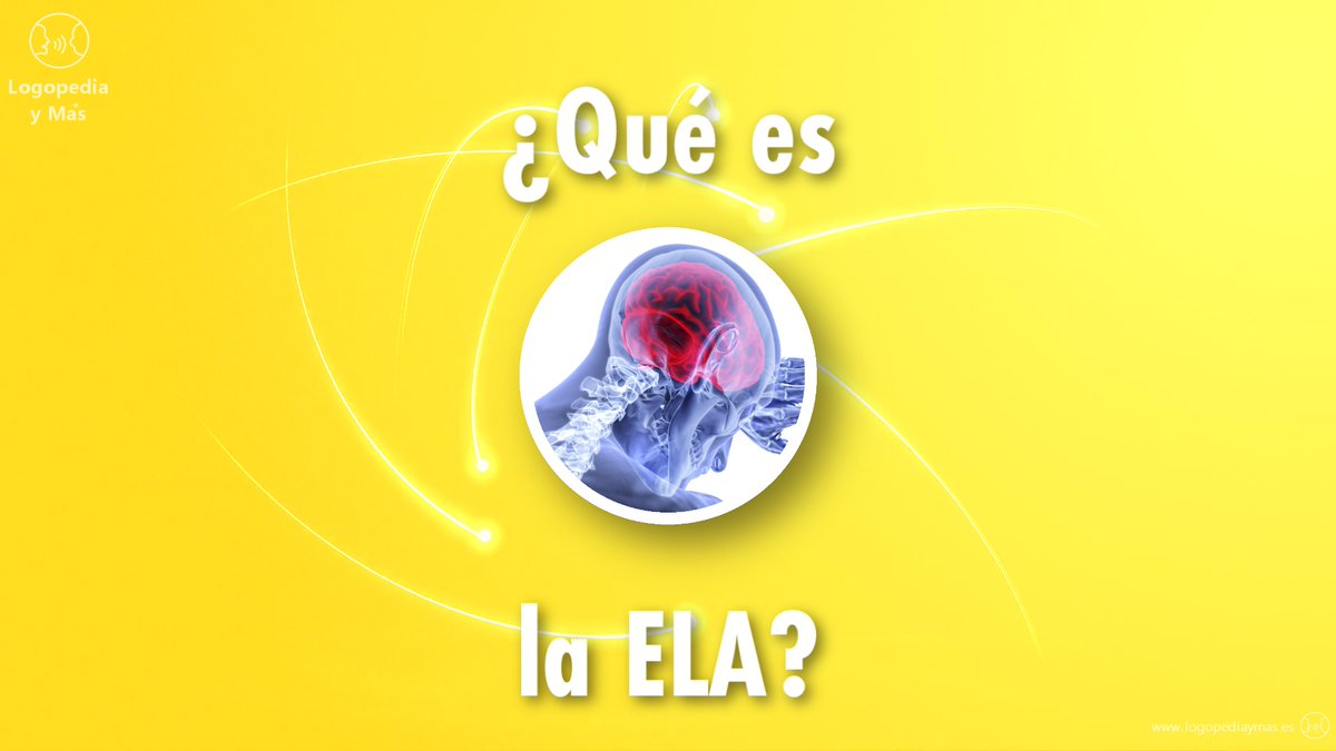 LogopediaYMas's tweet photo. ¿Qué es la ✅ ELA? Te lo explicamos 🚀aquí abajo 👇.

https://t.co/M7MguNBKbd

#ela #esclerosislateralamiotrofica #esclerosislateralamiotrófica #logopedia #logopediaymas #logopediamadrid https://t.co/GqN01waJaX