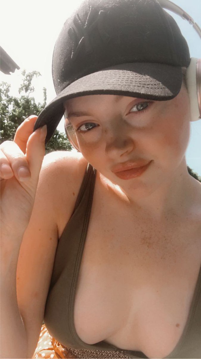 emmhiggss's tweet photo. Low-key miss when I had an allergic reaction 2 years ago and my lips looked like I’d had decent fillers https://t.co/RqPJ8paew9