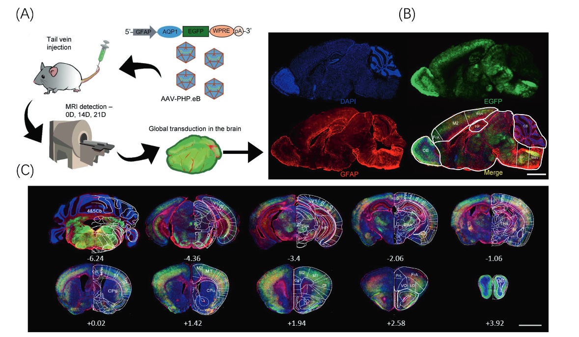 molpsychiatry's tweet photo. In vivo imaging of astrocytes in the whole brain Witherspoon engineered AAVs and diffusion-weighted magnetic resonance imaging. By Mei Li et al. @WHUni_Official #astrocytes #neurons #diffusionimaging #MRI #neuronalnetworks https://t.co/1wT8QaxQH4 https://t.co/iu6VguTt3b