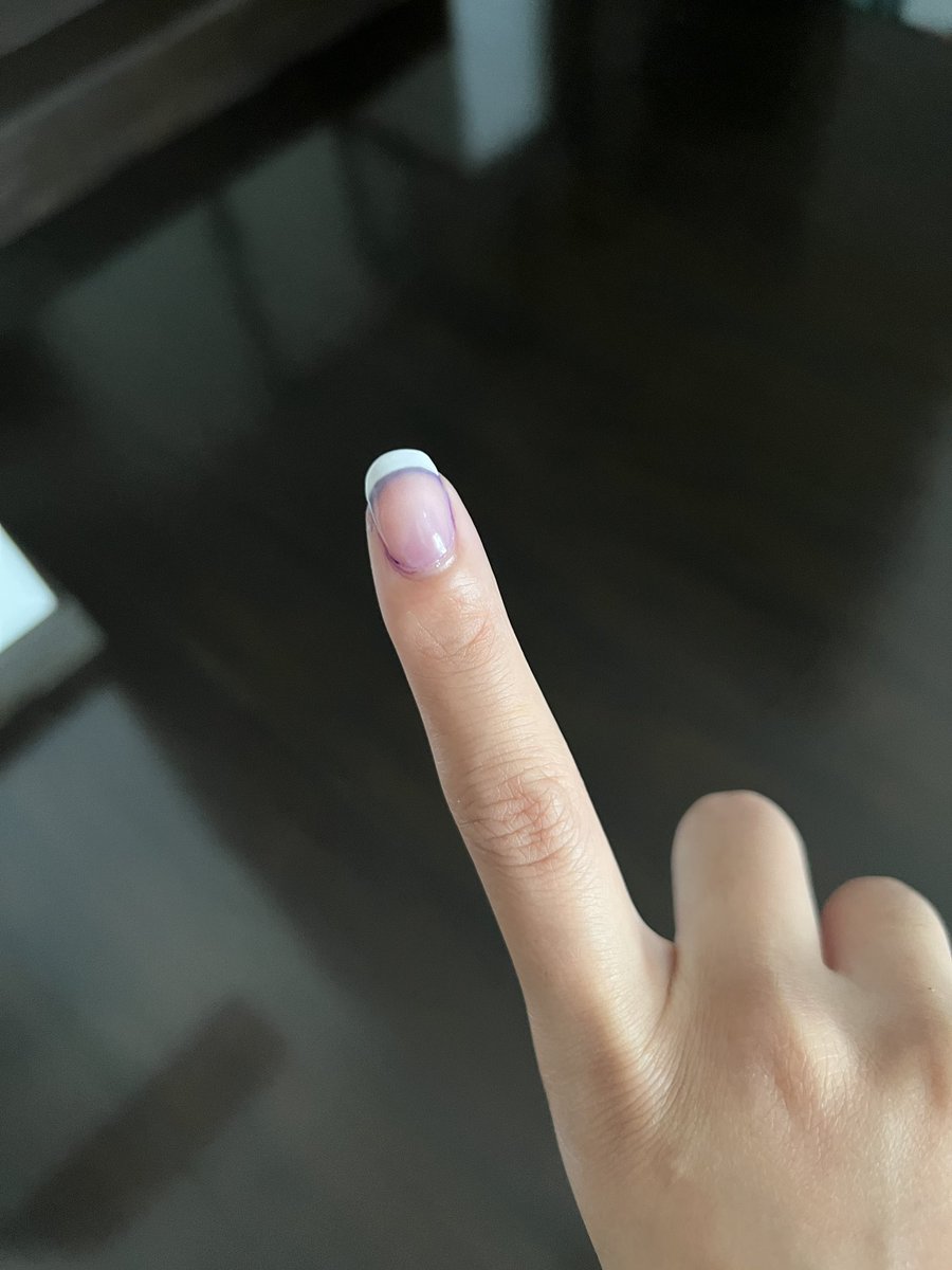 riaherce's tweet photo. @LegendofPO Naging nail art https://t.co/CeWzxJdG9A