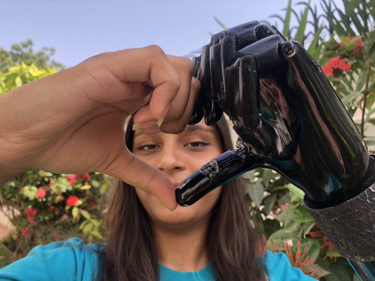 Bioniksorg's tweet photo. Beneficiary Amna hopes you all had a great weekend and sends her love for the rest of the week.
#prosthetic #bioniks #blackx #superheroarm #prostheticlimbs #bionics #bionicarms #biotechnology https://t.co/wN5BkF3BkN