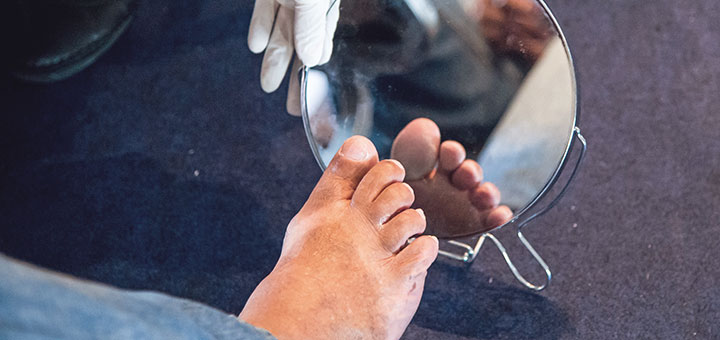 Biotechsa's tweet photo. National Diabetes Foot Care Report - https://t.co/7Yt1LnGYlx
#Ortopedia #Traumatologia #biotechsa #news https://t.co/WeKss3C8kY