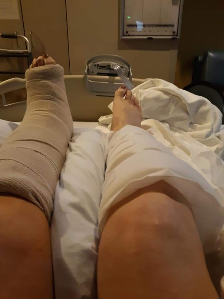HyltonAndi's tweet photo. A year of hell  from a fall from a latter and end up losing my foot and part of my leg .... https://t.co/SPCzKus0Yj