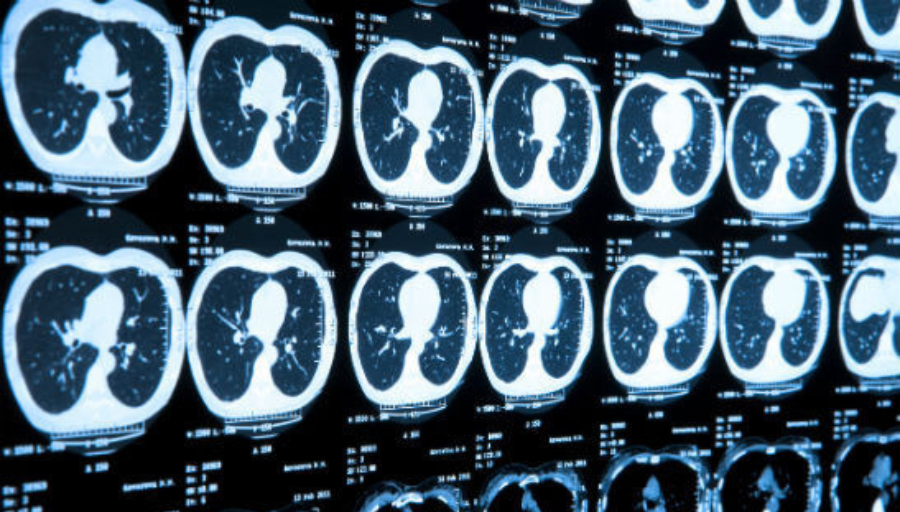 ICR_London's tweet photo. 📣 The joint annual meeting of the @ISMRM and @ESMRMB kicked off on Saturday.
The six-day event overlaps with #InternationalMedicalPhysicsWeek and will feature sessions on the latest developments in the field of magnetic resonance imaging (#MRI).
#IMPW https://t.co/UAf4GzJGfo
