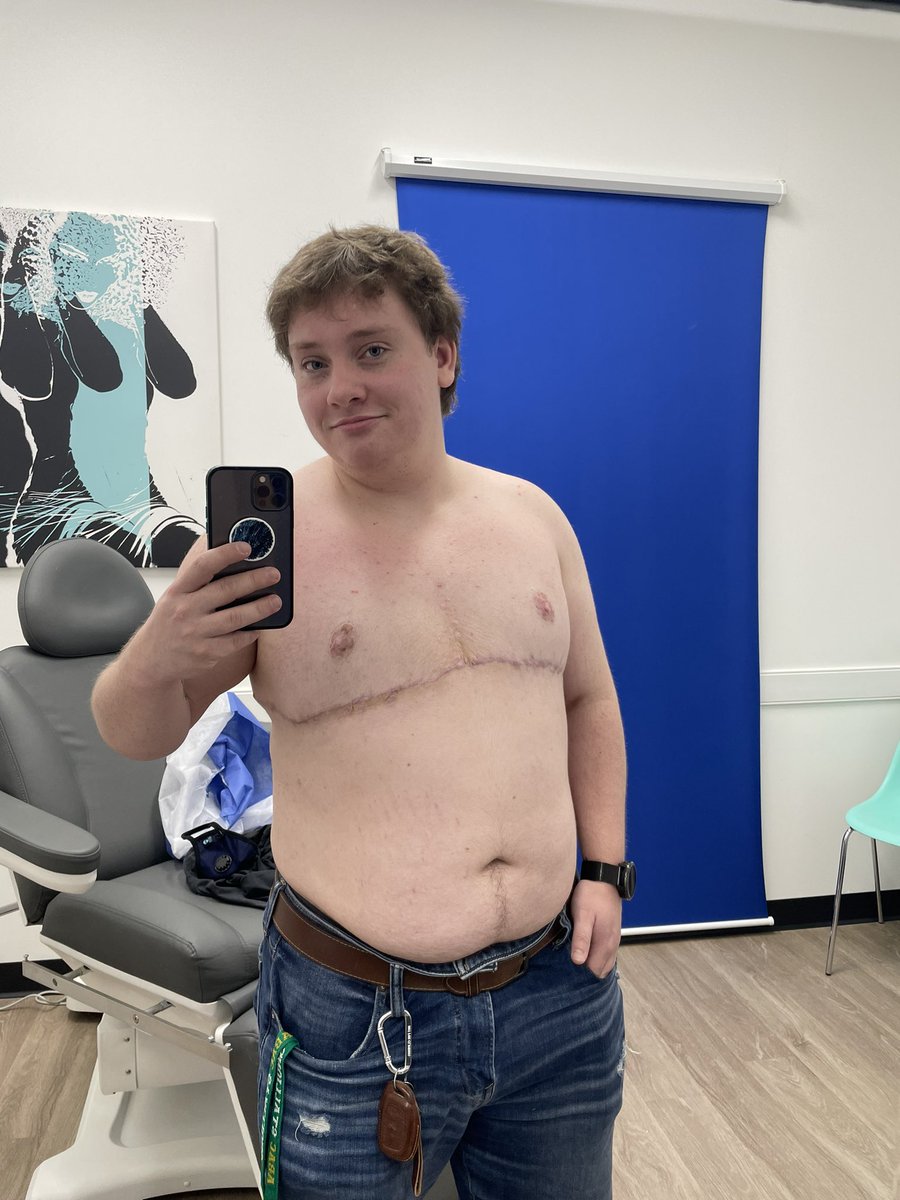 HamOnABicycle's tweet image. 9 months post op! Absolutely insane how fast time flies