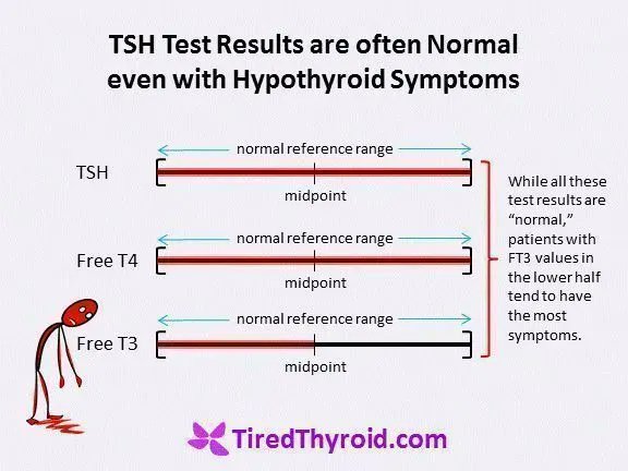 Tsh alto significado