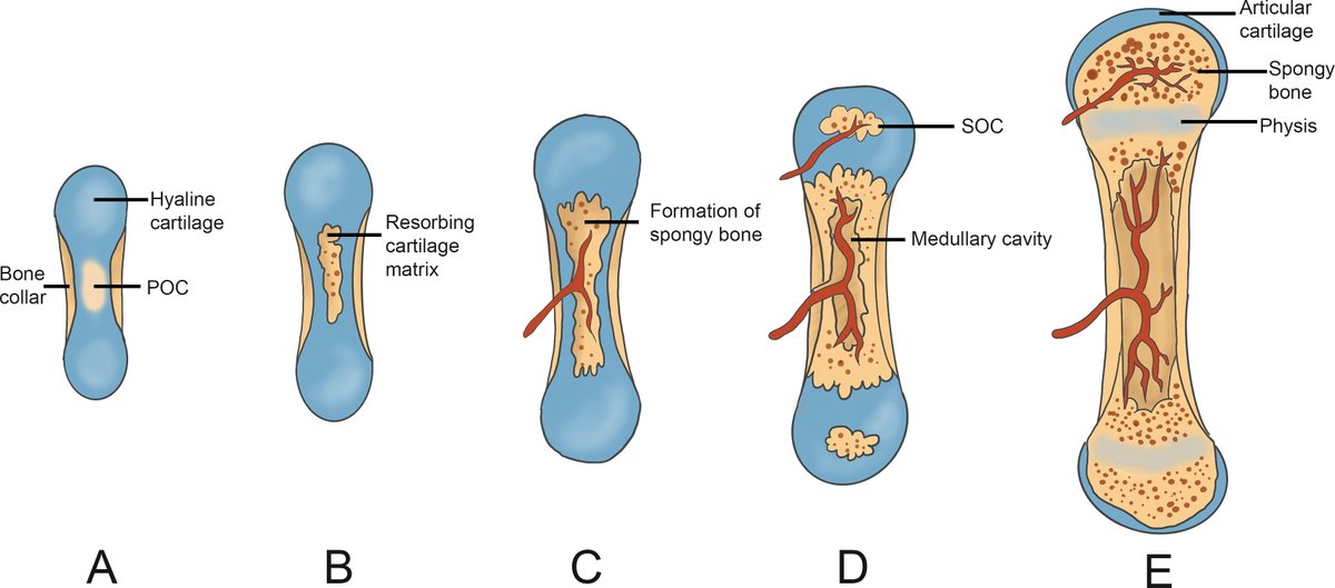 RadioGraphics's tweet photo. Pediatric skeletal development and maturation follow an orderly and predicable pattern. Knowlege of normal development assists in recognizing normal variants and many unique diseases of the pediatric skeleton. https://t.co/lsRxYT60GL @aclaugusto @dyannotdiane @andreaihara https://t.co/EPQUojBeCv
