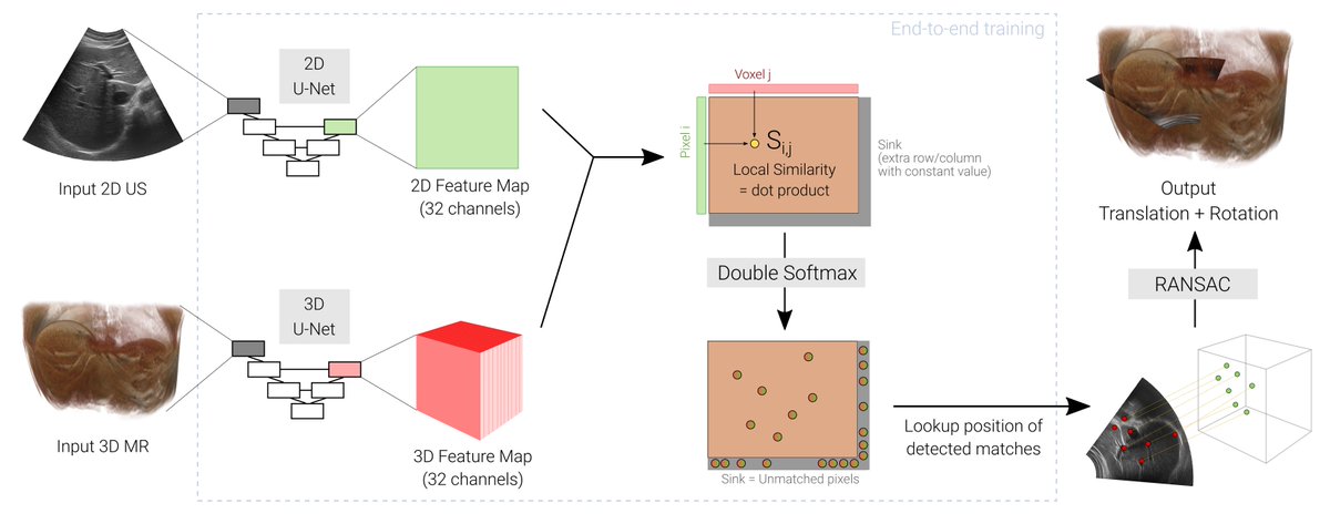 ImFusion (@imfusiongmbh) on Twitter photo Congratulations <a href="/matteoronchetti/">matteo ronchetti</a> and <a href="/vi_markova/">Viktoria Markova</a> Markova from our Ultrasound team whose paper titled ´Global Multi-modal 2D/3D Registration via Local Descriptors Learning´ has been accepted early for #MICCAI 2022 publications. Congratulations <a href="/matteoronchetti/">matteo ronchetti</a> and <a href="/vi_markova/">Viktoria Markova</a> Markova from our Ultrasound team whose paper titled ´Global Multi-modal 2D/3D Registration via Local Descriptors Learning´ has been accepted early for #MICCAI 2022 publications.