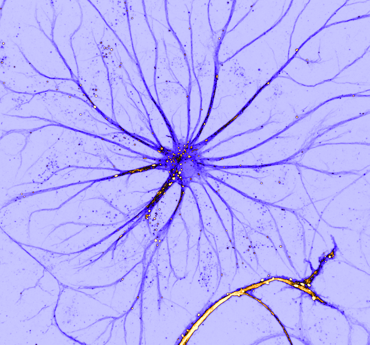 Today's astrocyte!