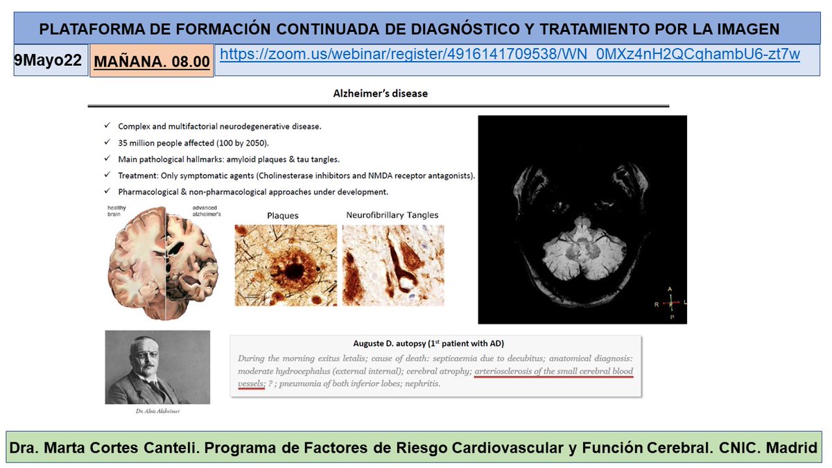 salvasapedraza's tweet photo. Great lecture by Dra Marta Cortes Canteli about “Experience with PET probes in preclinical models of Alzheimer's disease " with moderation from Dr Nerses Nerseyan. @hospitalclinic @CNIC_CARDIO @SEMNIMoficial @SENR_org @seneurologia @idibgi   @AreaHjt @myESR @RSNA https://t.co/dhNFWgNPuq