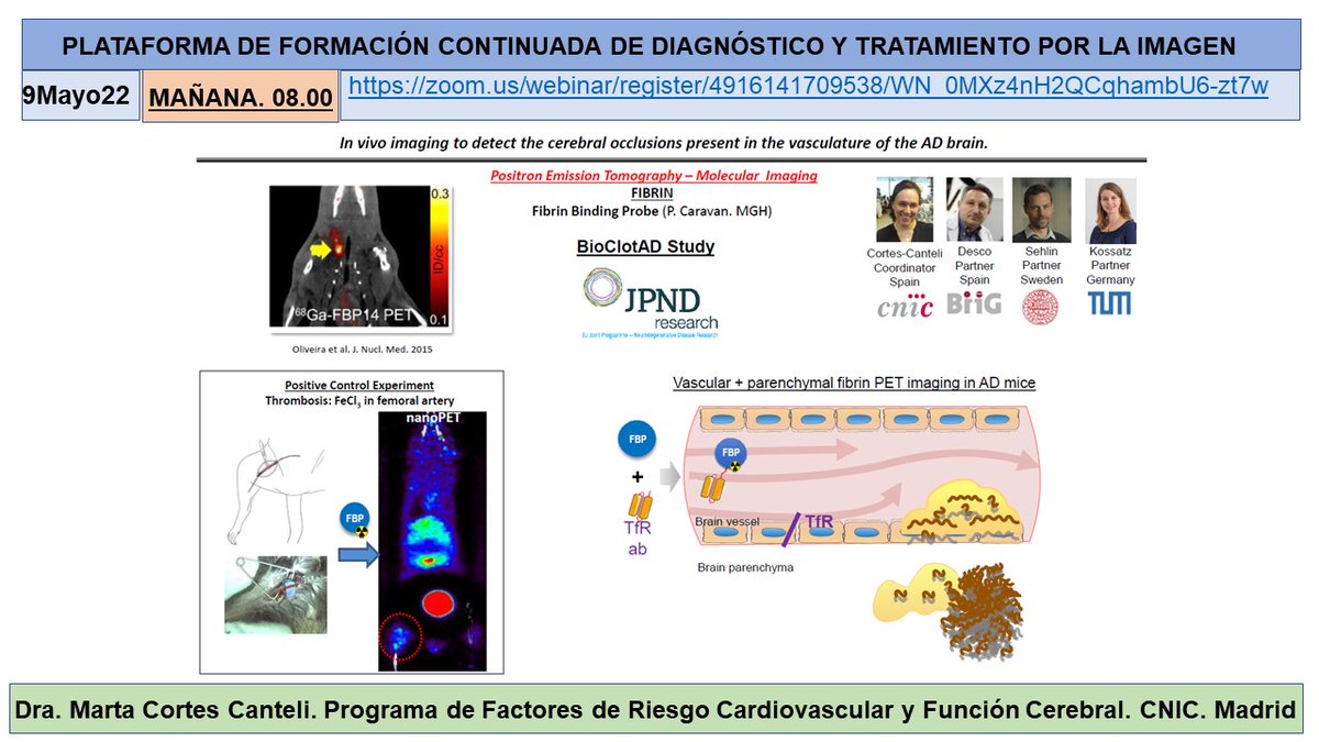 salvasapedraza's tweet photo. Great lecture by Dra Marta Cortes Canteli about “Experience with PET probes in preclinical models of Alzheimer's disease " with moderation from Dr Nerses Nerseyan. @hospitalclinic @CNIC_CARDIO @SEMNIMoficial @SENR_org @seneurologia @idibgi   @AreaHjt @myESR @RSNA https://t.co/dhNFWgNPuq