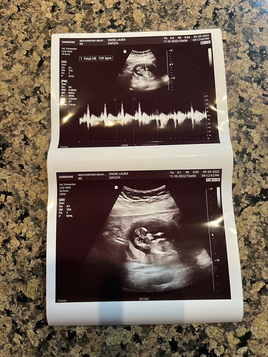 luluuulaura's tweet photo. LIFE UPDATE: I’m having a sweet baby boy!🥹💙 https://t.co/NUsSka3PnX