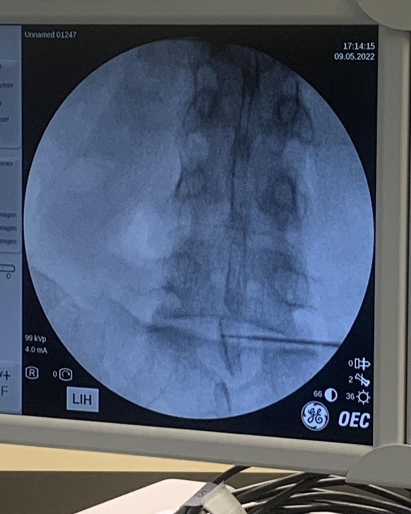 Dr. Mendiola de la Osa tweet media