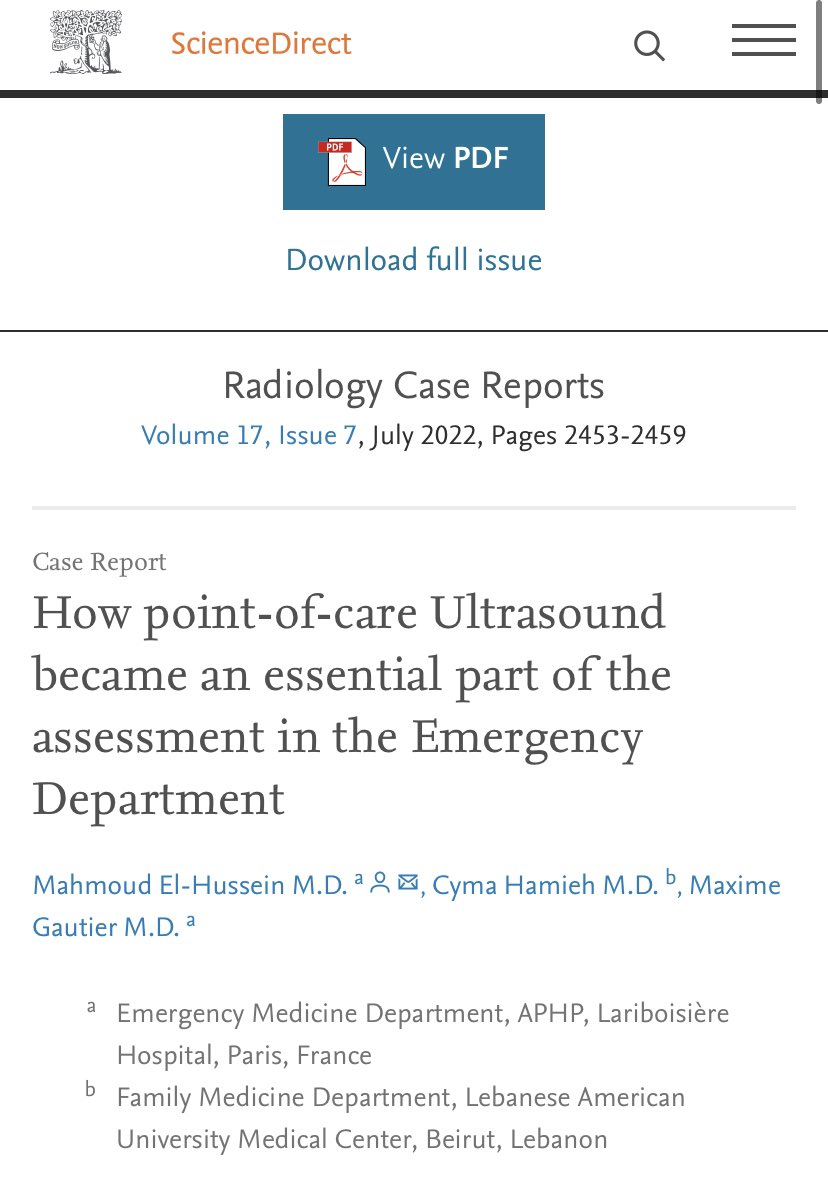 MahmudElHussei1's tweet photo. 🚨New published Article! Its a patient I managed with my mentor @maxgau1 who taught me everything I know about #ClinicalUltrasound. It highlights the importance of #POCUS in the #EmergencyDepartment. @CymaHamieh
 https://t.co/lUYIGgewyH https://t.co/sRyaisl4em