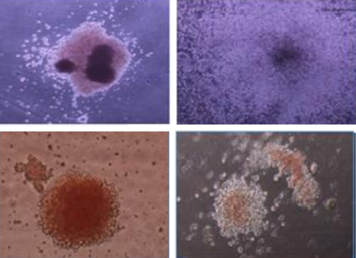 stemjnl's tweet photo. New study in #StemJournal shows how researchers at Université Paris Saclay generated &amp; characterized a unique CML iPSC from of TKI-resistant patient leukemic cells.

View full article: https://t.co/tEjMoJ8QMD
View extract: https://t.co/LTMgZCdQfr

#StemCells #Research #OpenAccess https://t.co/2lSruC260r