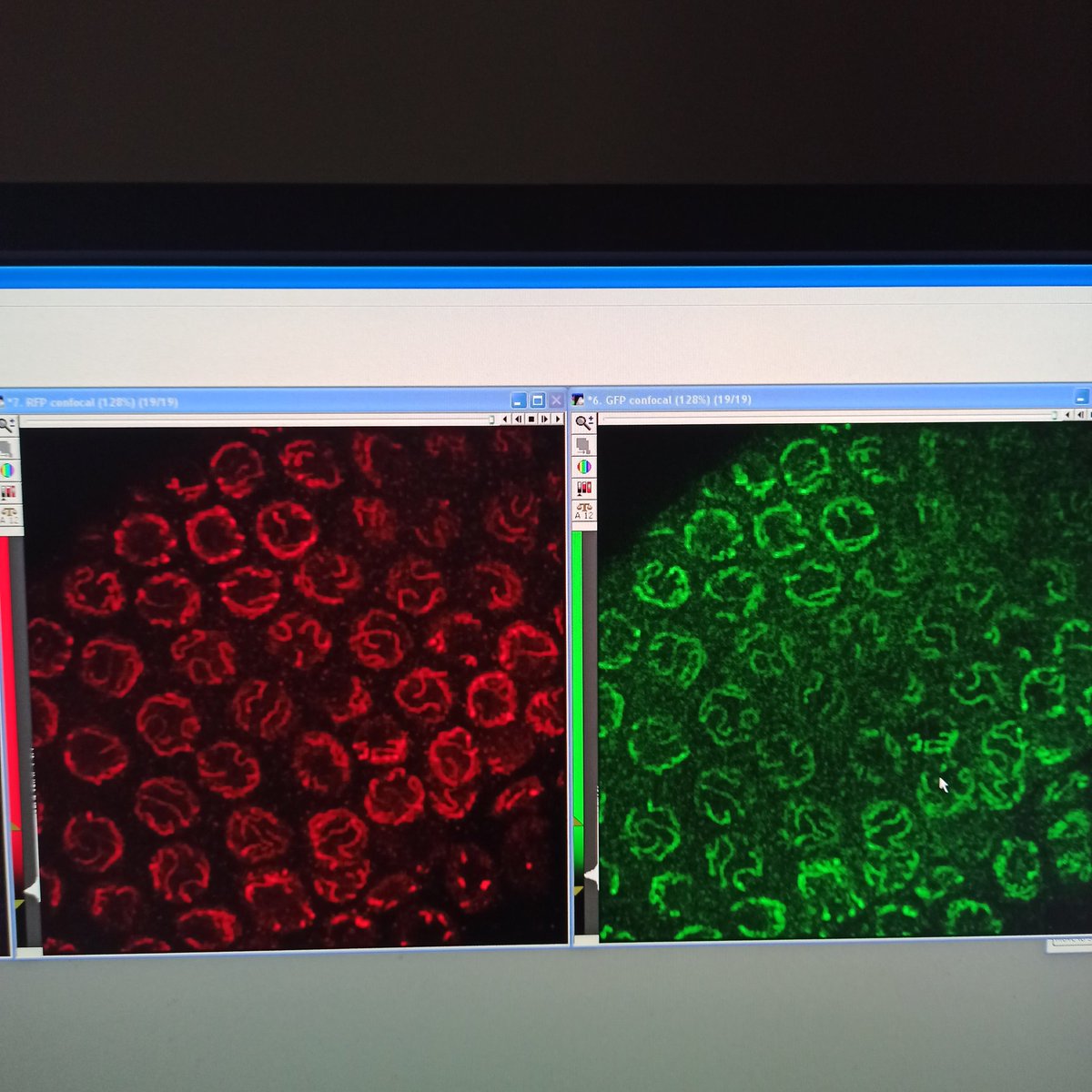 Purple_biology's tweet photo. Monday morning!
#meiosis
#HTP3
#C_elegans https://t.co/NDnNUMRENK