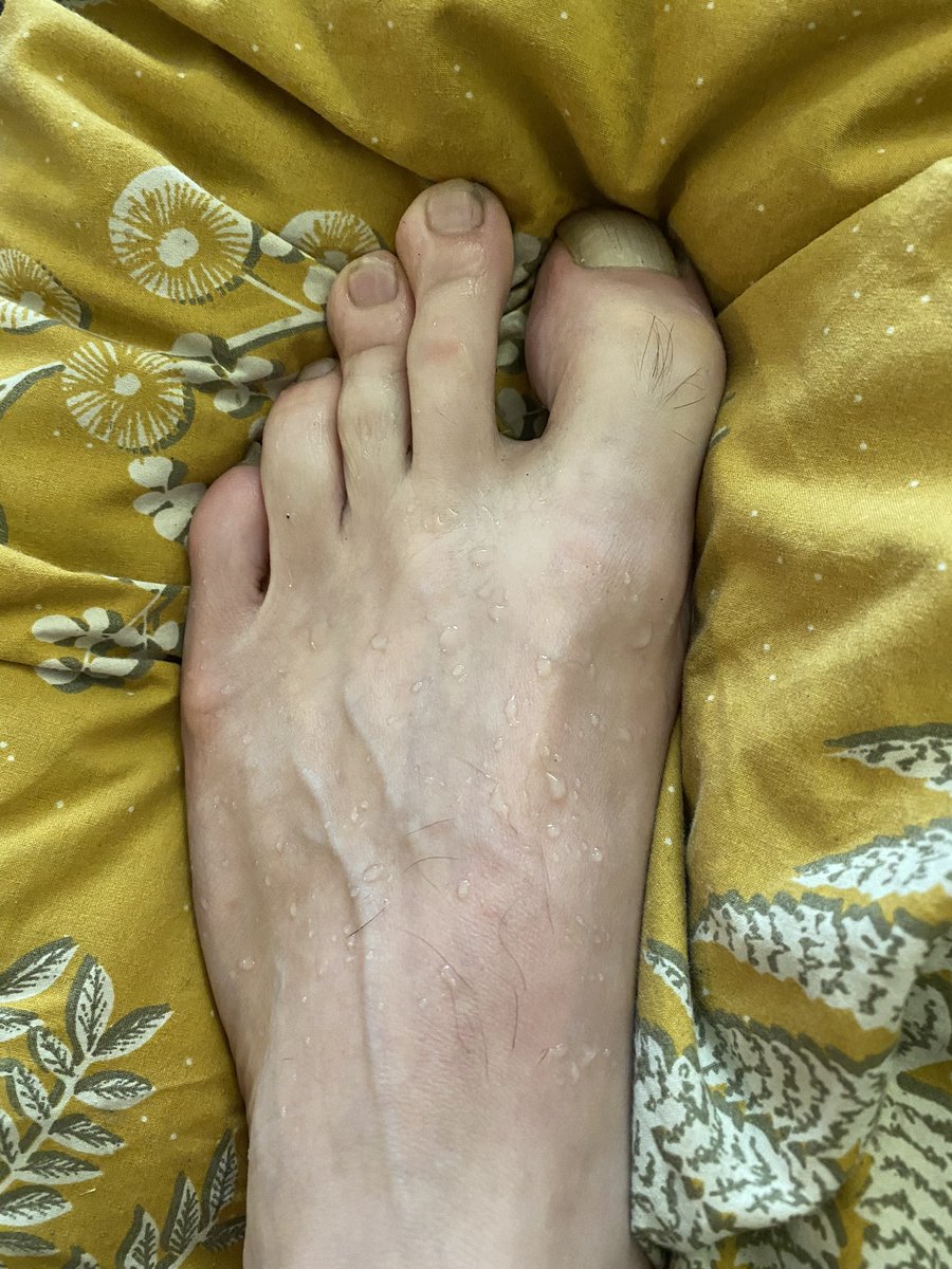 master_prepuce's tweet photo. Je me suis pisse sur les ieps. T’attend quoi pour nettoyer sale pute ? https://t.co/YgrAeUPBAU