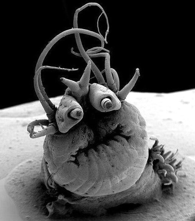 tapeworm under a microscope