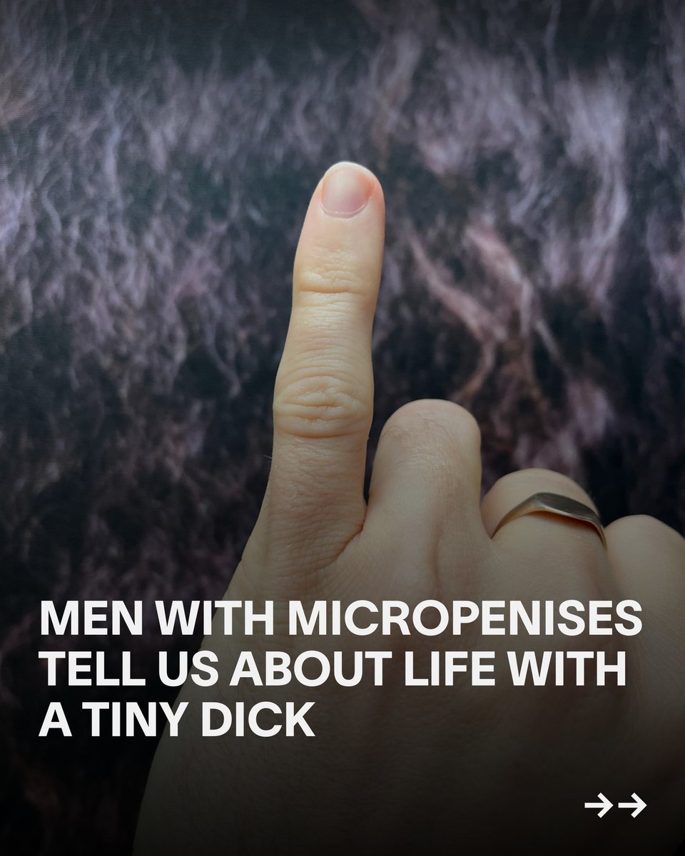 JustSayFukIt216's tweet photo. Do you or someone you know suffer from #MicroPenis ?
#JSFI🖕🏽 #TYSM🤌🏽 #BPP👌🏽 https://t.co/HvExTgHntK