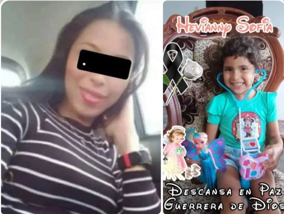 Falleció de un paro respiratorio,la niña Hevianny Estrada,quien fue envenenada por su madrastra,hace aproximadamente dos meses, en el estado Trujillo.