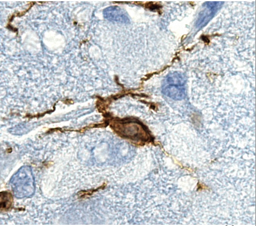 Dr Bobbi Fleiss (@bobbifleiss) on Twitter photo Hello, I am Dr Bobbi Fleiss, I am sharing what I do for <a href="/pintofscienceAU/">Pint of Science AU</a>
#MyScienceMay #AvidResearch #ThisIsMyScience #PintAU22 #BeautifulMind
Microglia are my passion – these are small (micro) cells that live in the brain and act like glue (glia). 1/4 🧵 Hello, I am Dr Bobbi Fleiss, I am sharing what I do for <a href="/pintofscienceAU/">Pint of Science AU</a>
#MyScienceMay #AvidResearch #ThisIsMyScience #PintAU22 #BeautifulMind
Microglia are my passion – these are small (micro) cells that live in the brain and act like glue (glia). 1/4 🧵