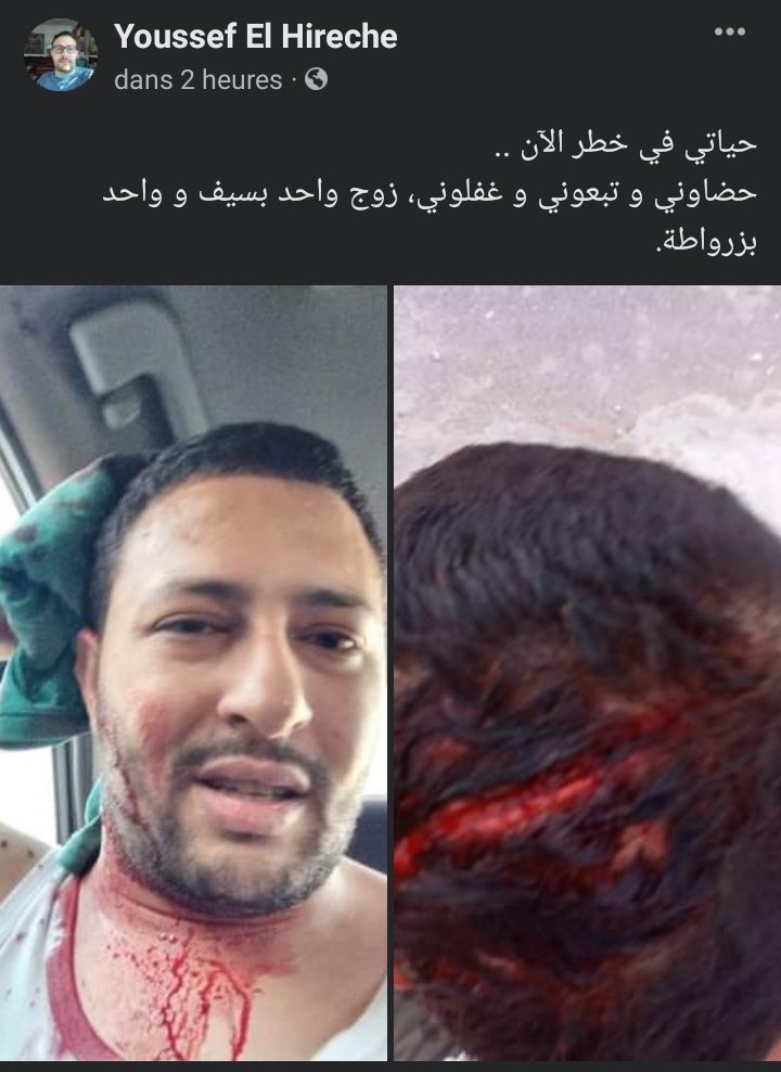 BernaniAfaf's tweet photo. المدون و الحقوقي يوسف الحيرش  يتعرض لمحاولة القتل   من طرف مجهولين في الشارع العام. https://t.co/ECtyHBYjzI