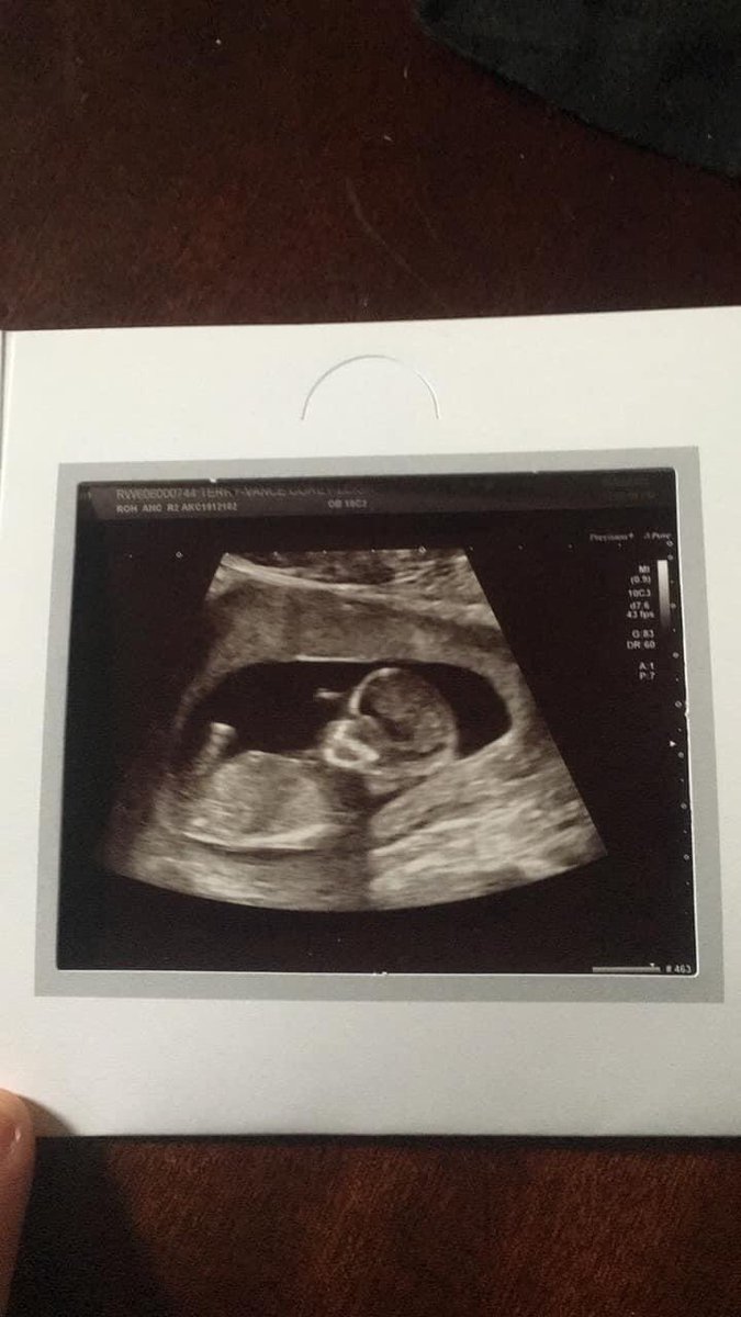 Corey_x04's tweet photo. Finally able to announce that I am pregnant 🤰 I can’t wait to see my baby I love you loads baby me and dad loves you 🥰🥰❤️❤️ https://t.co/7rrxBEvuMA