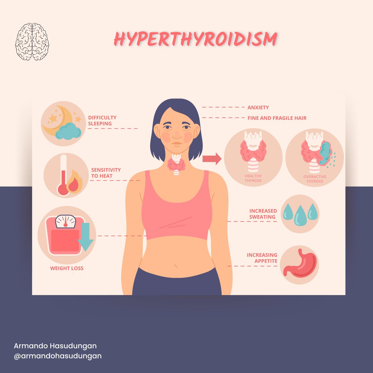armandohasudung's tweet photo. Hyperthyroidism or overactive thyroid occurs when the thyroid gland produces too much of the hormone thyroxine
Read full post @ https://t.co/jy5gNpblwI
More concepts @ https://t.co/obHZvkTE4Z
#hyprthyroidism #thyroidgland #overactivethyroid #thyroidhormone #thyroxine #goiter https://t.co/7xGWDRdgQM