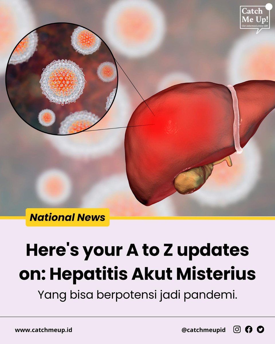 Guys, attention! 

Menteri Kesehatan Budi Gunadi Sadikin mengkonfirmasi bahwa sejauh ini udah ada 15 anak Indonesia yang diduga mengidap penyakit hepatitis akut misterius 😭😭😭