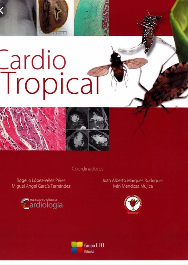 igormorr's tweet photo. Chagas Disease: Breaking the Silence https://t.co/YvOybITdIw vía @YouTube. #CardioTropicalSiac @mencardio @svcardiologia https://t.co/3LROWCohzj