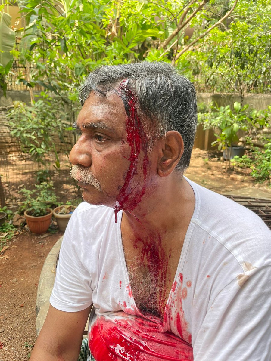 SabSeTezz1's tweet photo. Above Senior Citizen has been assaulted on his head by the above seen wooden drawer, Owner of the Car details mentioned in the Tweet. @maharashtra_hmo 
@ThaneCityPolice 
@SaamanaOnline https://t.co/KgYnVI3WUA