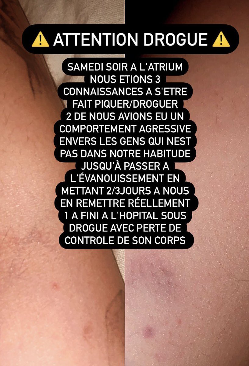 Connordbrks's tweet photo. ⚠️ REIMS ⚠️ https://t.co/aFLCdz5sNP