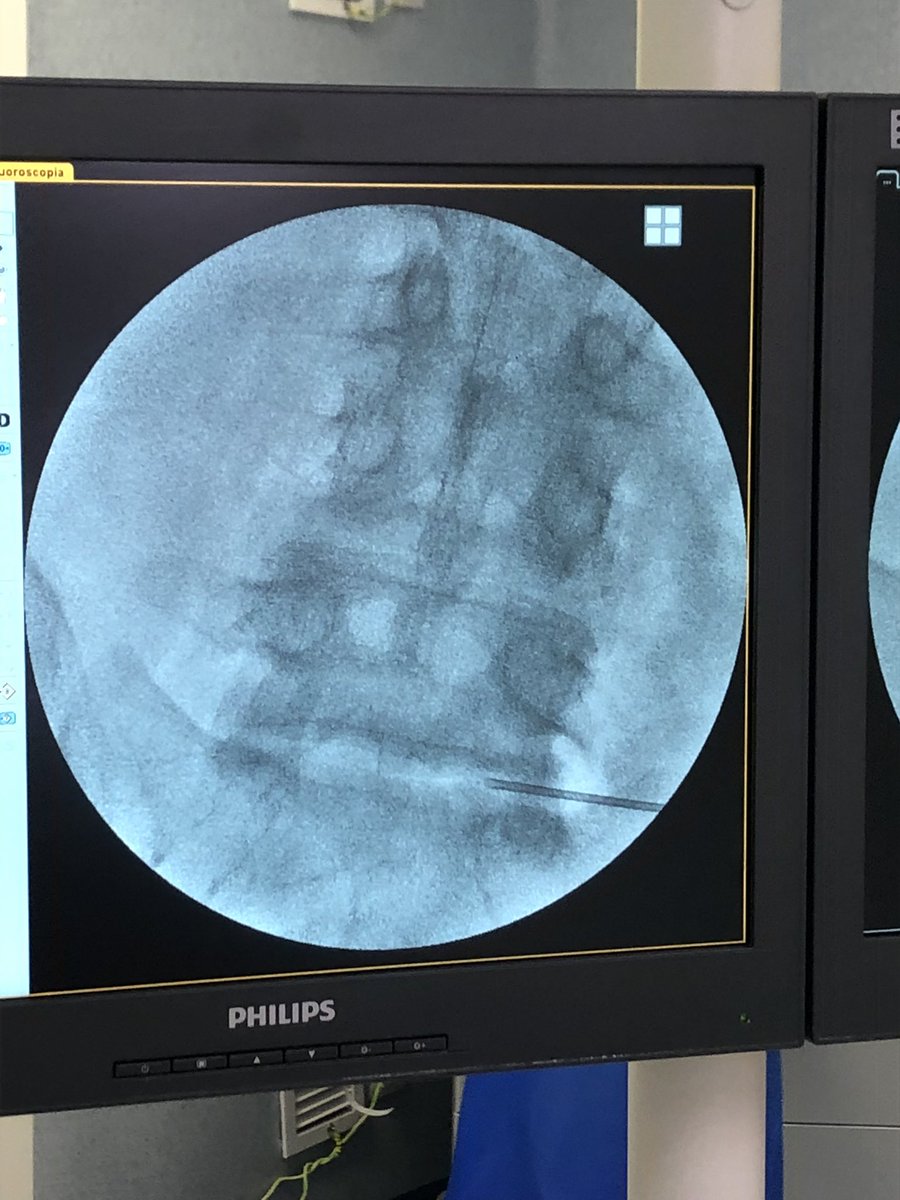 Unidad de Dolor HU Son Espases tweet media