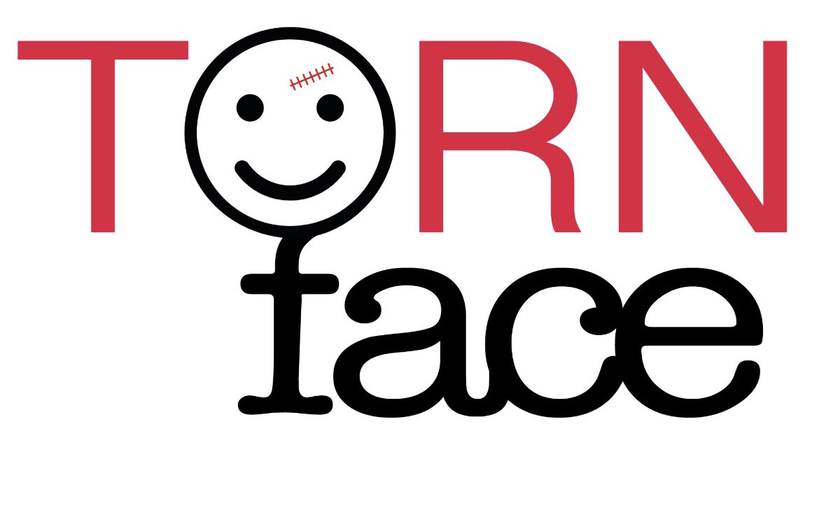 shadibasyuni's tweet photo. Just under 40% recruitment completed for the TORN Face trial. Still lots to do but shows that with right support trainee led research is possible! @BAOMSOfficial @BJOMS_official @CUH_Maxfac @CambridgeBRC @CUH_NHS @RCEMPolicyVP https://t.co/XJceQSHgkr