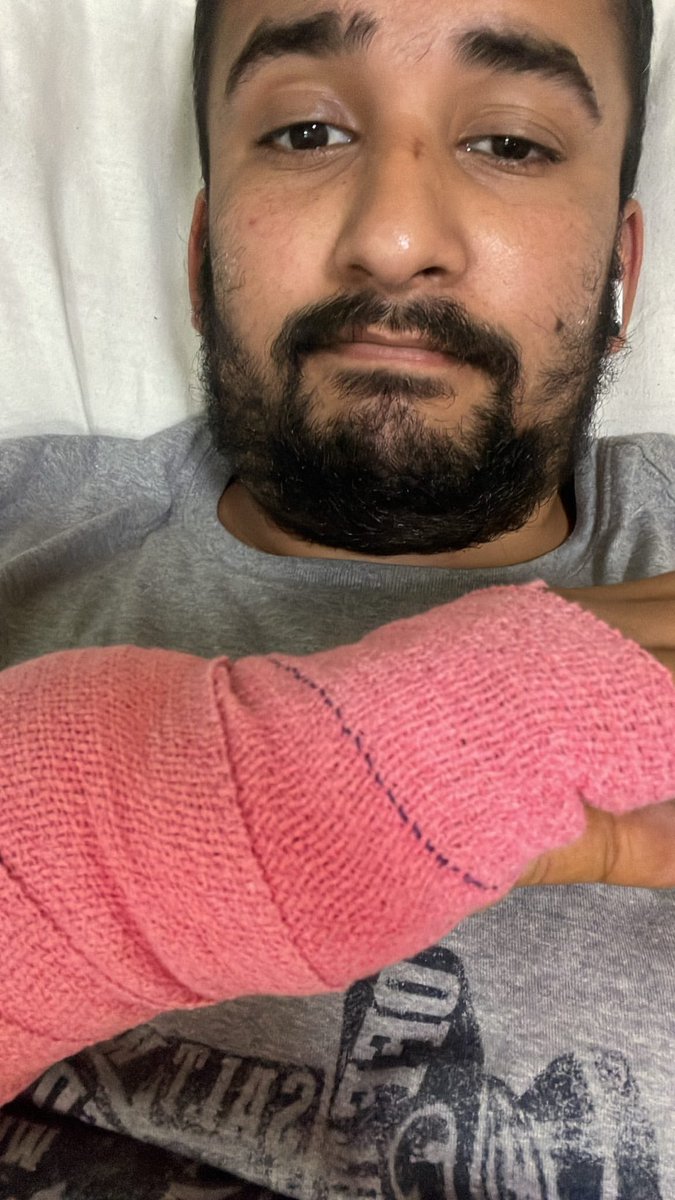 createwithabhi's tweet photo. Surgery Done ✅ Will be on ground soon. 

Thank you everyone for your best wishes 🙂🙏🏼❤️
#createwithabhi #surgery #ACCIDENT https://t.co/hJi3x3NIID