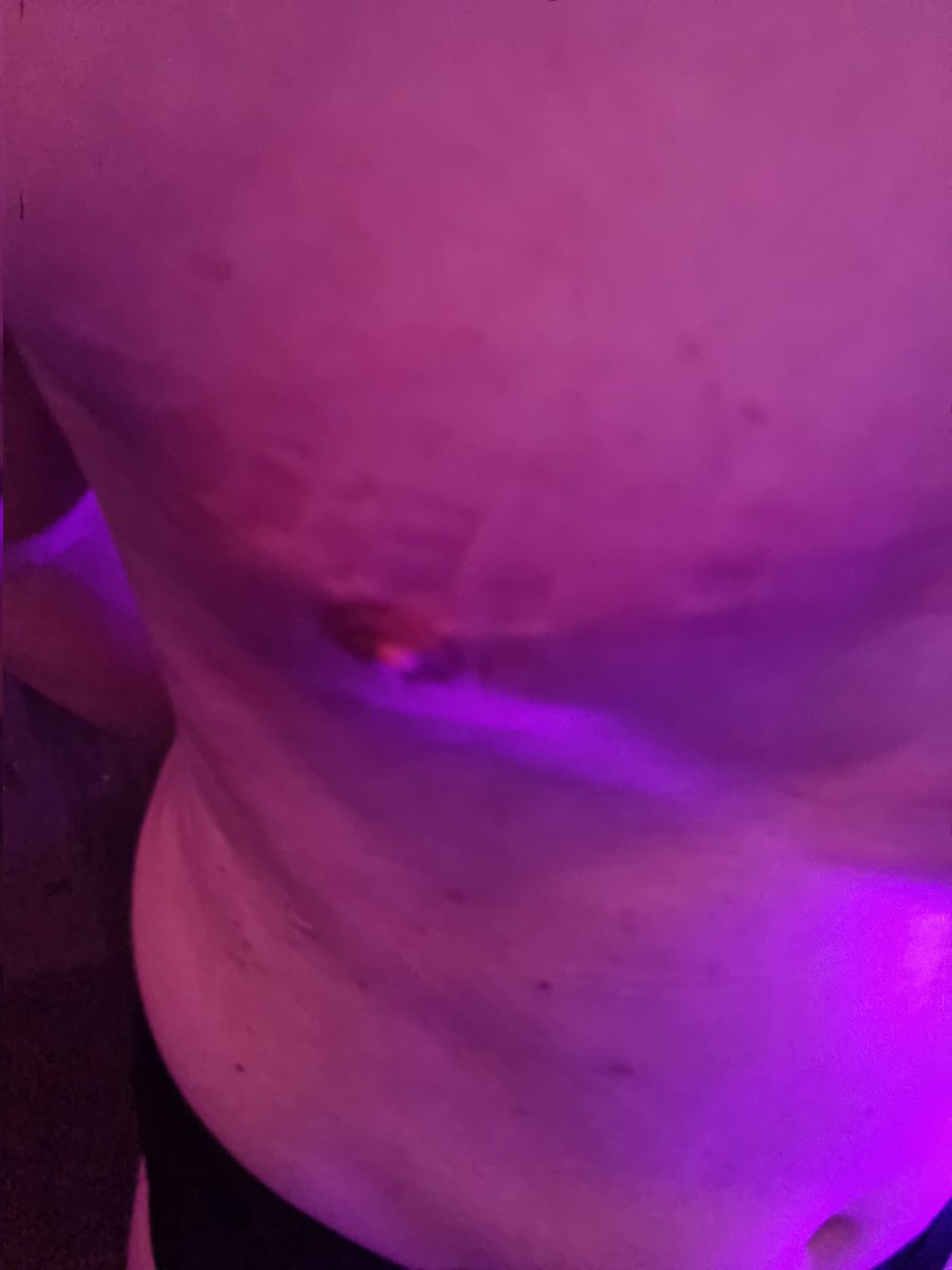 ComtesseAnn's tweet photo. Und hier noch einmal ein Nahaufnahme vom Klammerabdruck 
.
.
@ComtesseAnn 
#Dominatrix #domina #bdsm #Sissyprostitute #sissylife https://t.co/kBF32otu7U