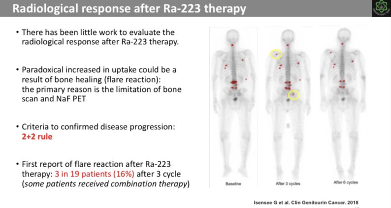 update_in_nm's tweet photo. Flare reaction could occur after Ra-223 therapy, 16% based on the report. The 2+2 rule is used to confirmed disease progression after the therapy. #xofigo #ra223 #prostatecancer #prostate #alphatherapy #alsympca #nuclearmedicine #nm https://t.co/Hc3qWFH3J7