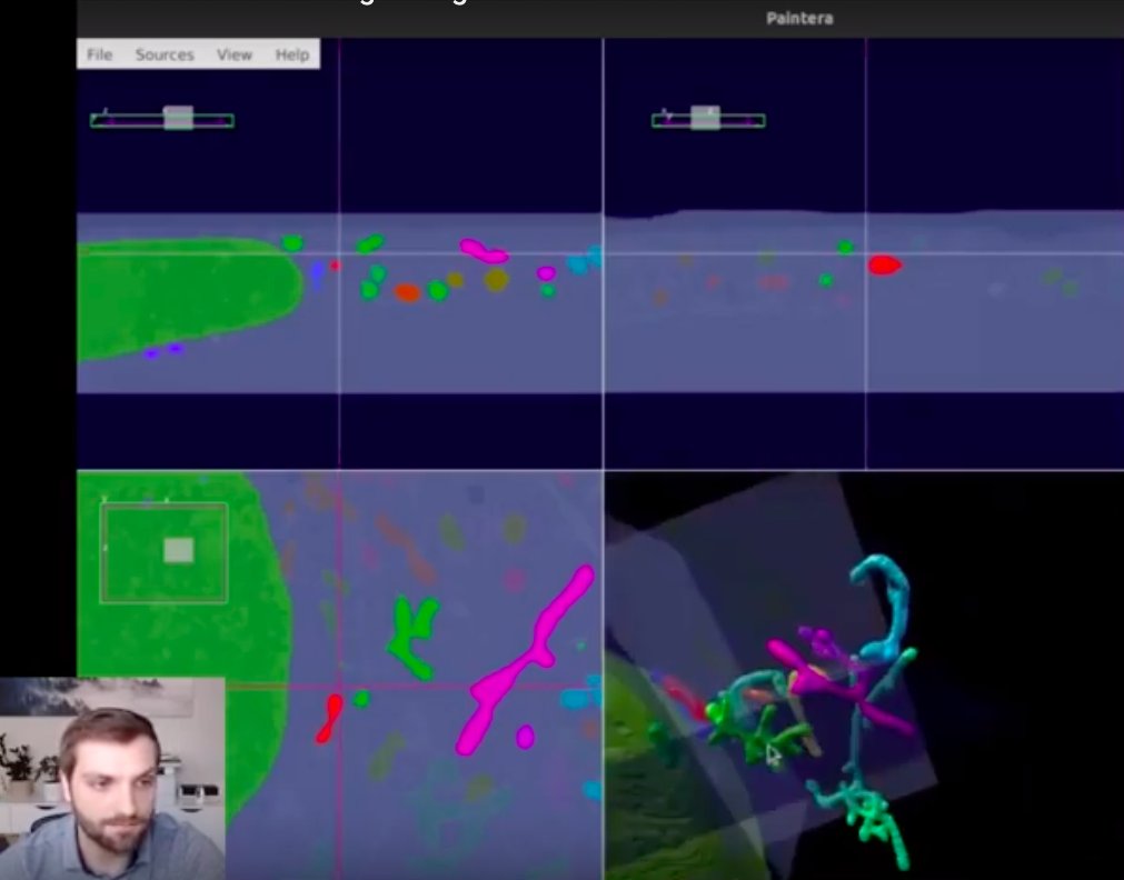 Last Friday <a href="/CmHulbert/">Caleb Hulbert</a> presented #Paintera at #I2K2022 . Here, showing some beautiful <a href="/COSEMdata/">COSEM</a> on openorganelle.org
youtube.com/watch?v=rNJotg…
github.com/saalfeldlab/pa…