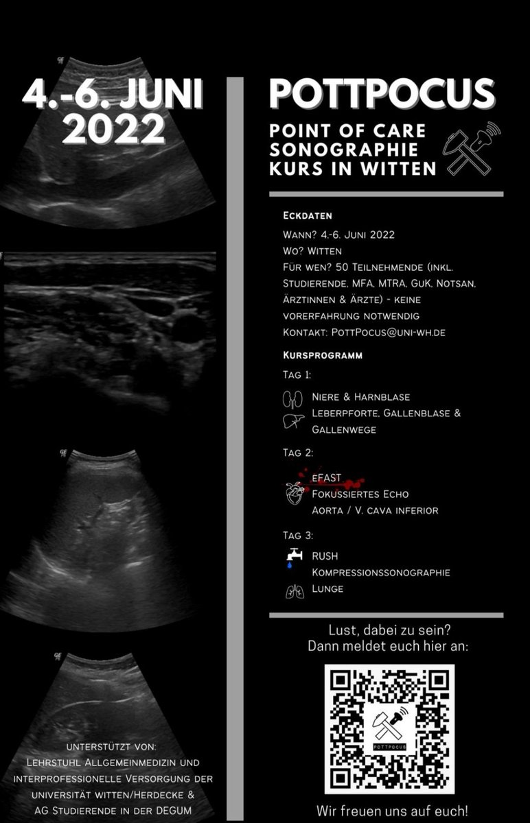 Bock auf Notfallsonokurs im Ruhrpott? Wir haben noch einige Restplätze für *Studierende* übrig! Werde PoCUS Schüler*in für 3 Tage von <a href="/GERpocus/">Felix Lorang DFTT</a> <a href="/alex_k1708/">Alex</a> und knapp 20 weiteren studentischen Tutor*innen aus ganz Deutschland.
supersaas.de/schedule/PottP…