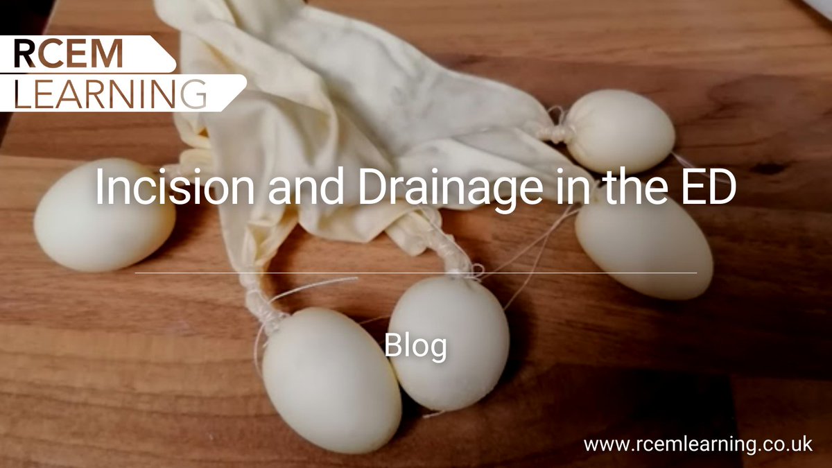 RCEMLearning tweet media