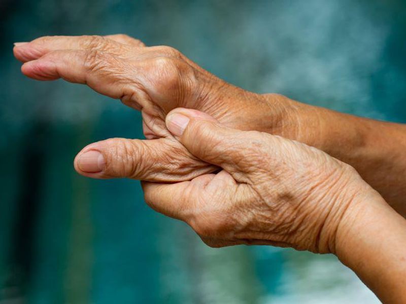 rapainmgmt's tweet photo. Prevalence of Multimorbidity Up in Rheumatoid Arthritis: https://t.co/Mln5ajvcfw https://t.co/7gt99NnlhQ