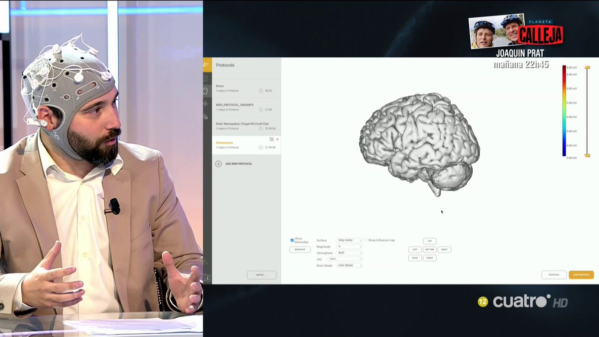 navedelmisterio's tweet photo. Esta tecnología busca ayudar a los pacientes con problemas cerebrales neurodegenerativos a través de técnicas no invasivas #Futura https://t.co/BTugnnP78Z