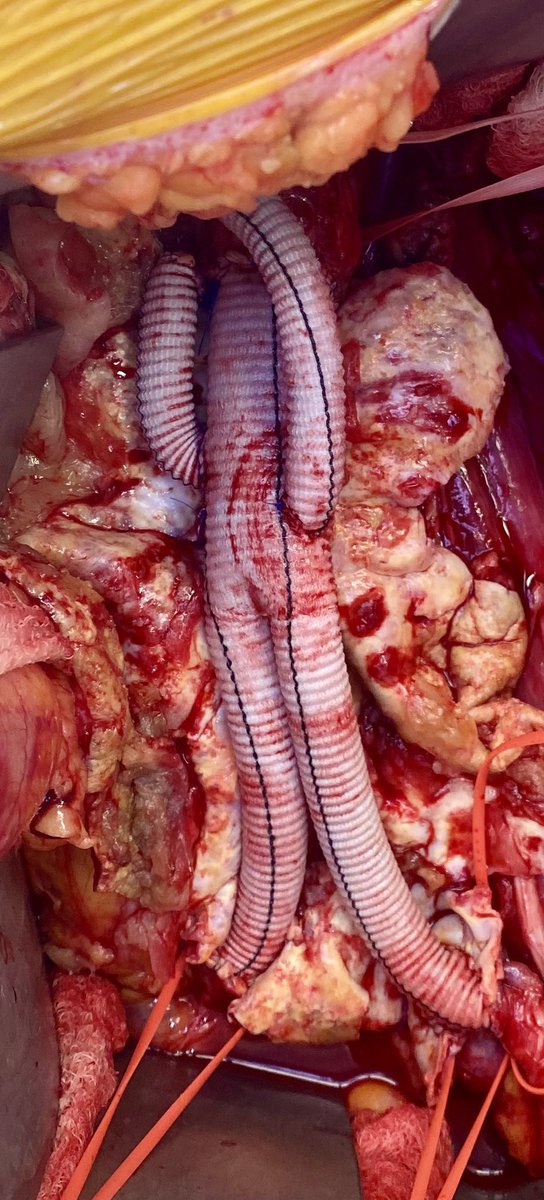 <a href="/mattsmeds/">Matthew Smeds</a> I nicknamed this one Gumby but I like wavy inflatable arm flailing tube man too