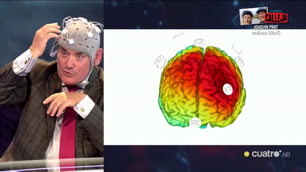 navedelmisterio's tweet photo. A los pacientes con depresión se les electroestimulan determinadas áreas del cerebro para mitigar esta afección mental #Futura https://t.co/zBr5wQm0el