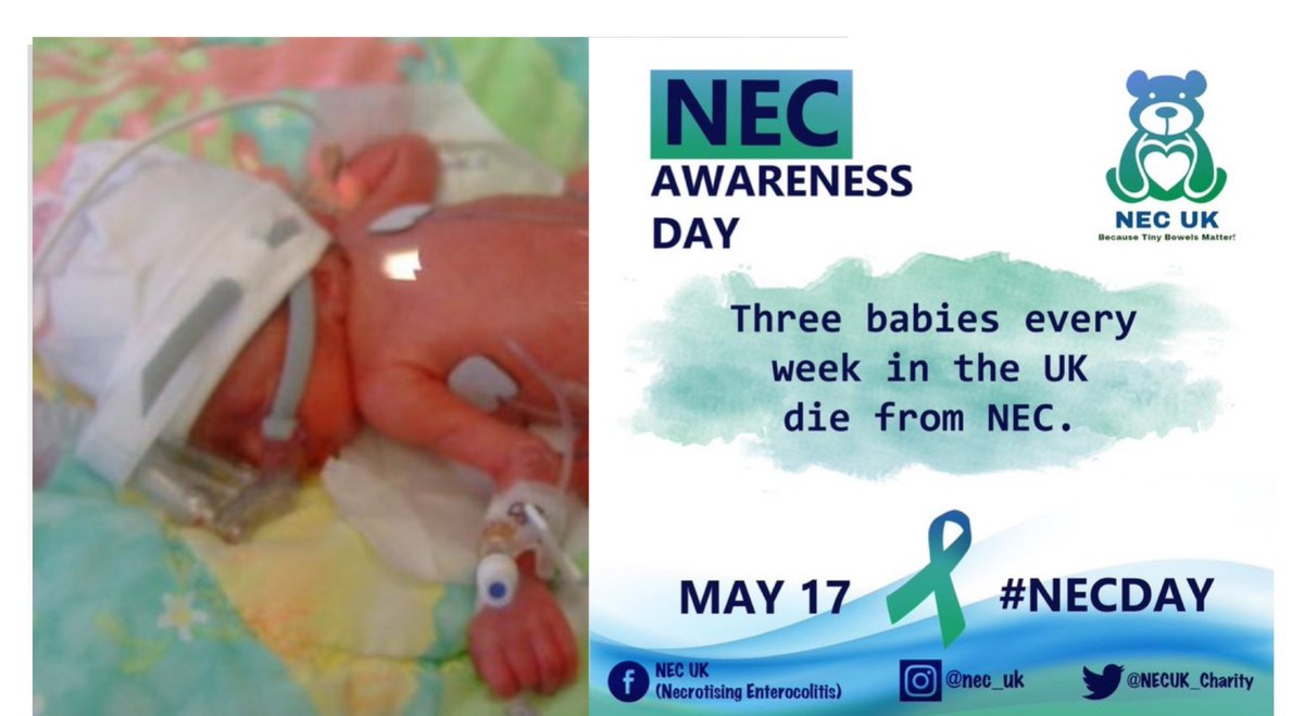 dion_0918's tweet photo. #NECday #necawareness #necsurvivor #tinybowelsmatter 💙💚 https://t.co/tTjK1kZ358