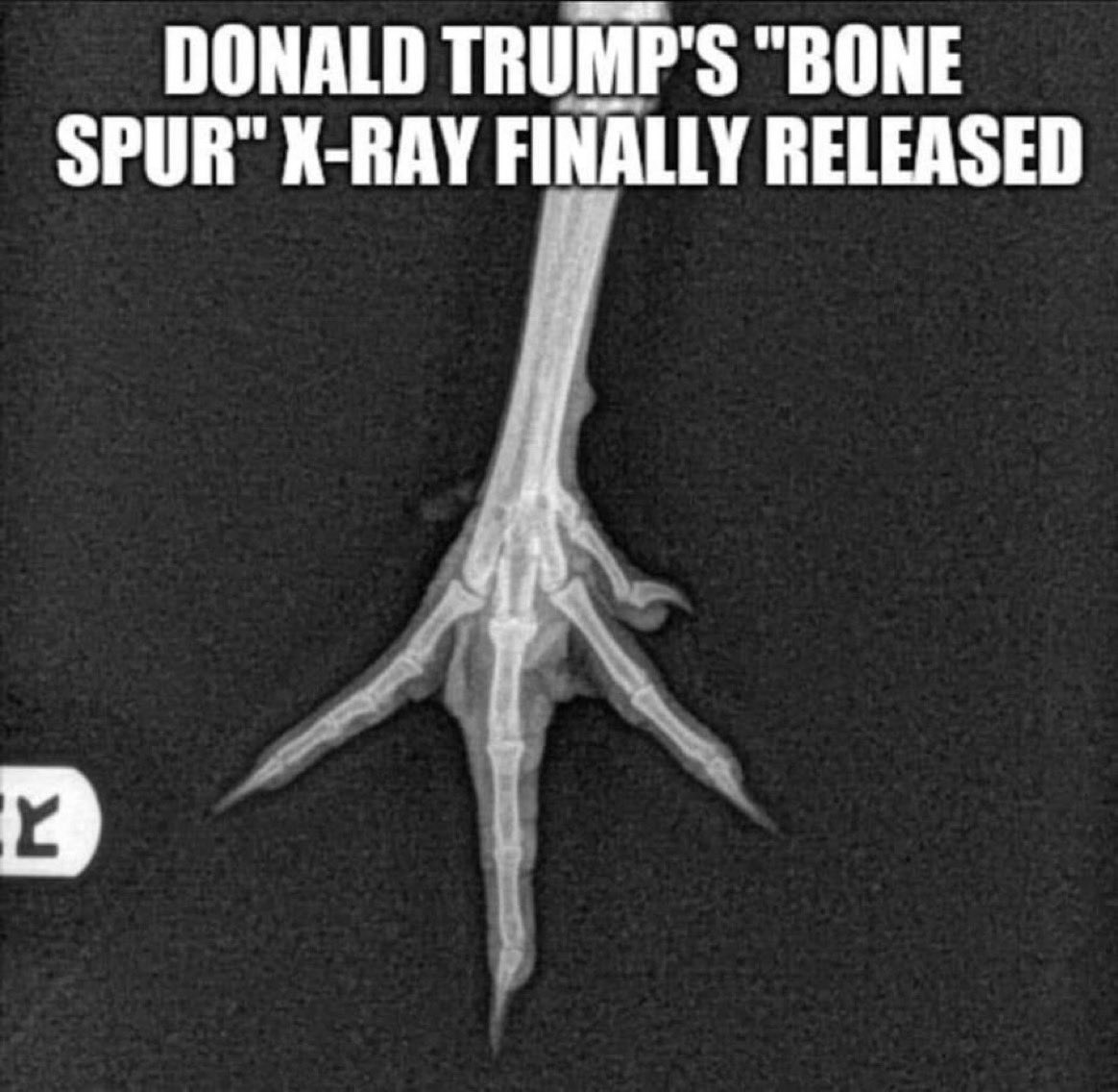 RT @LePapillonBlu2: Mr. Bone spurs coward Trump X-ray. https://t.co/D3GR3K7Eg5