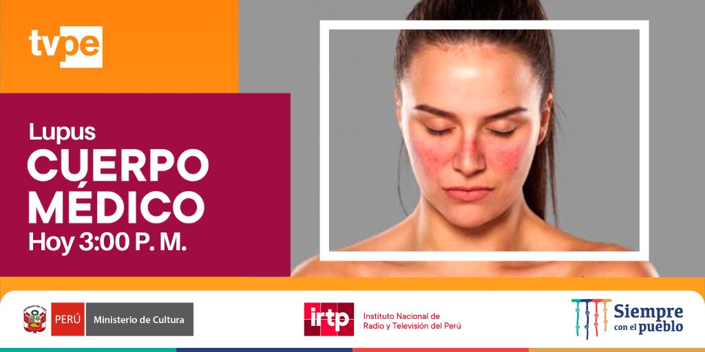 tvperupe's tweet photo. Hoy en @cuerpomedico_tv hablaremos sobre el lupus, una enfermedad inflamatoria ocasionada cuando el sistema inmunológico ataca a sus propios tejidos. 🩺
👉 Recuerda que también puedes ver el programa por Facebook Live, a las 3 p. m.  📱
#TodosSomosTVPerú https://t.co/t2mnHdDqCA